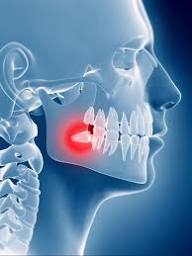 Toothache