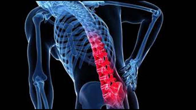 Backache